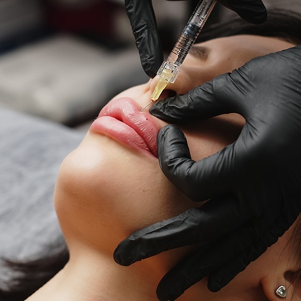 lip fillers