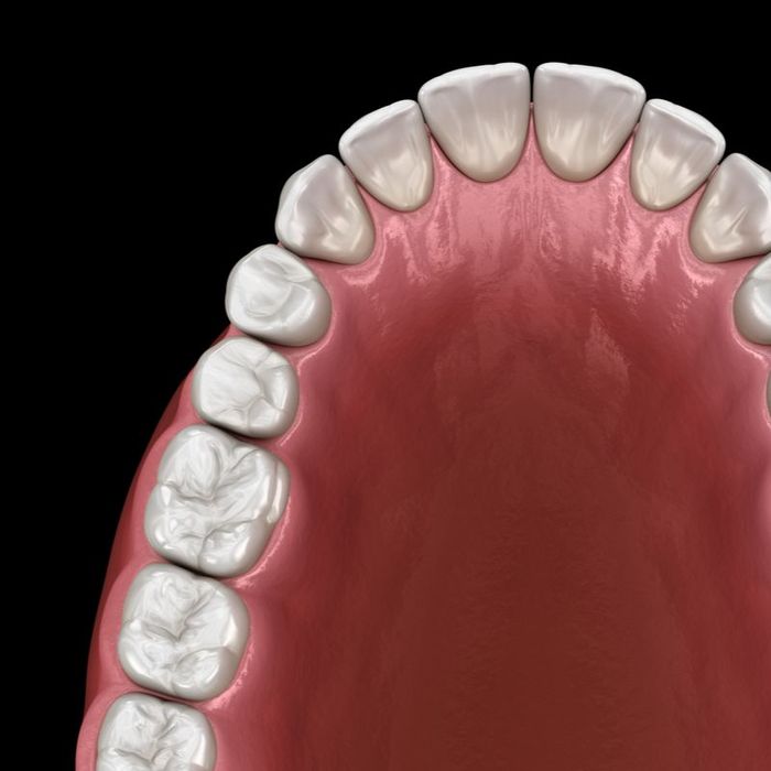 Full Mouth Reconstruction