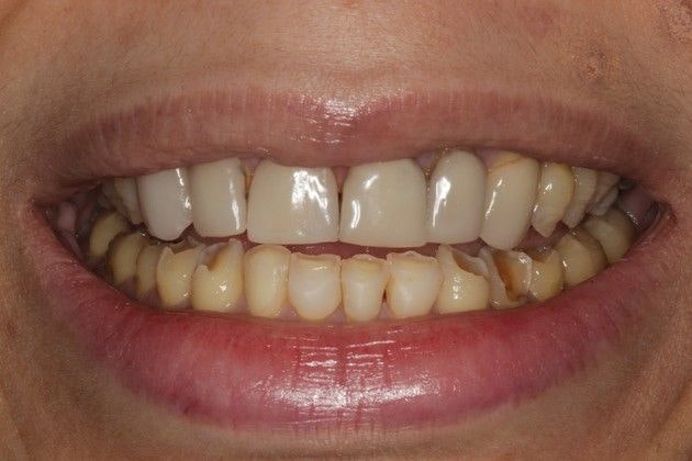 Before treatment