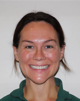 Michelle after Invisalign