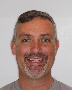 Ron before dental work