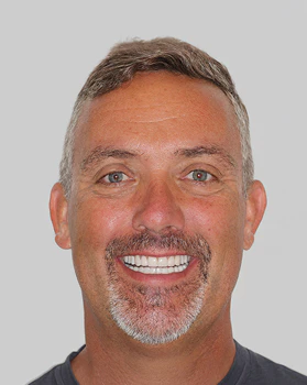 Ron after dental work