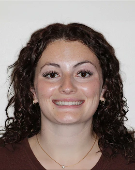 Isabelle after veneers