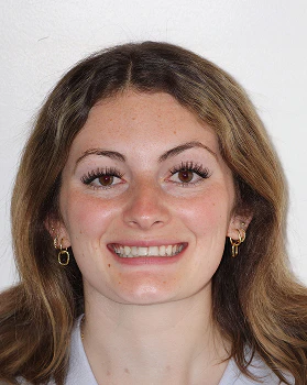 Isabelle before veneers