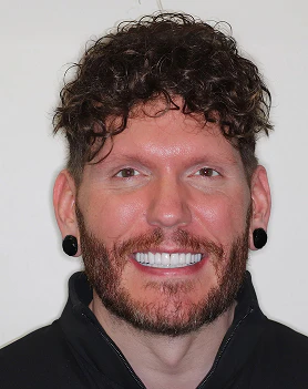 Travis after smile makeover