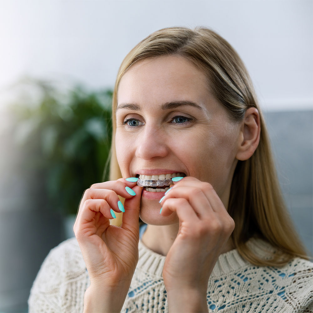 woman putting in clear aligner