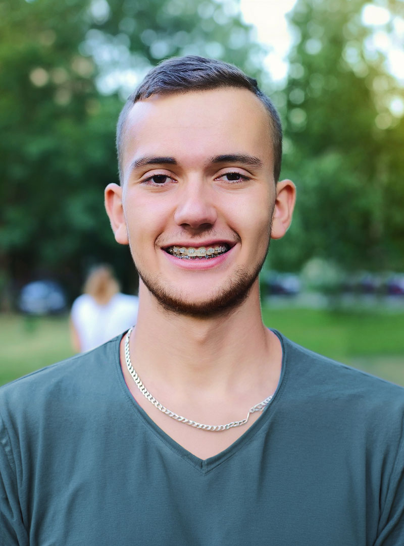 young man wearing damon braces