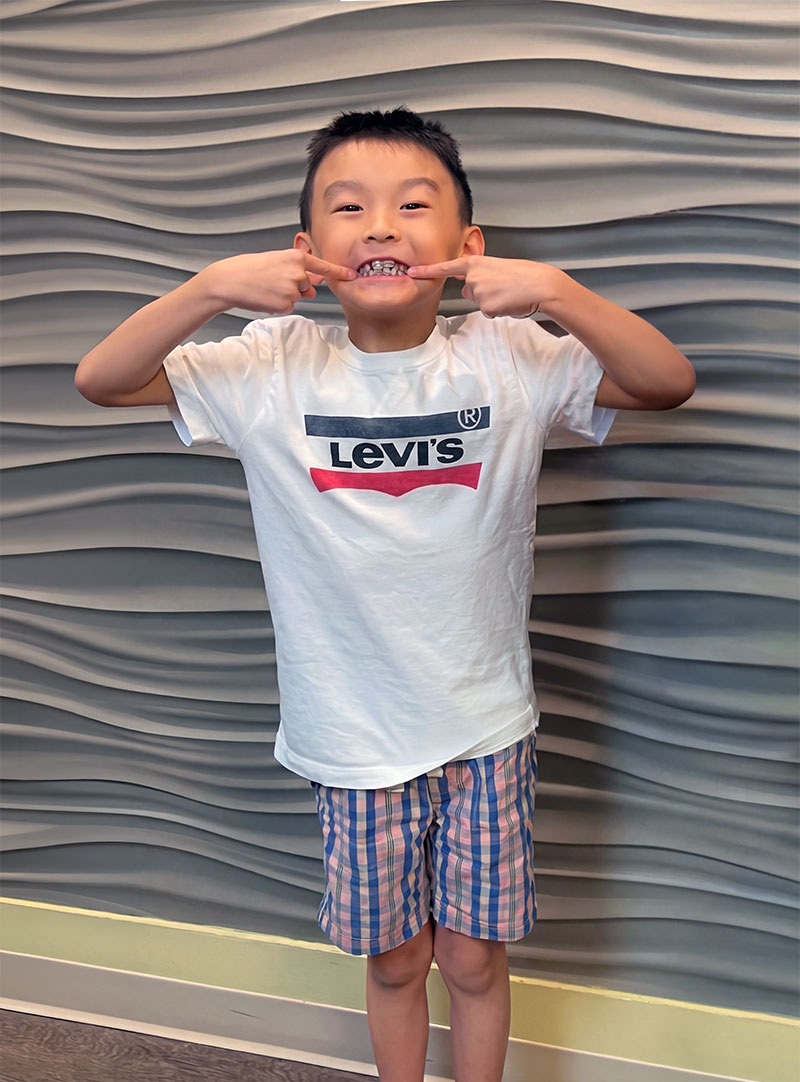 Our patient pointing at his smile