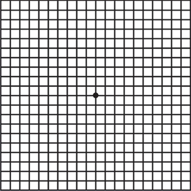 Normal eyesight when viewing Amsler grid