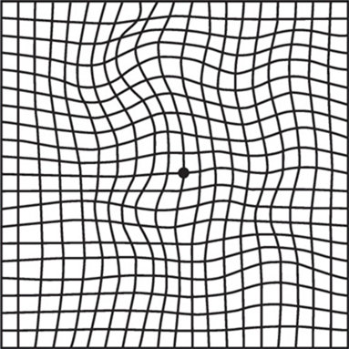 Normal eyesight when viewing Amsler grid