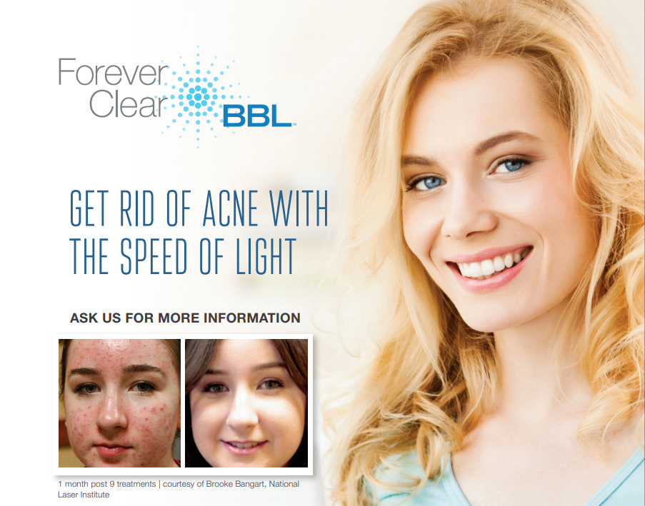 stock image of a female model smilimg - Forever Clear BBL with before and after paitent picture
