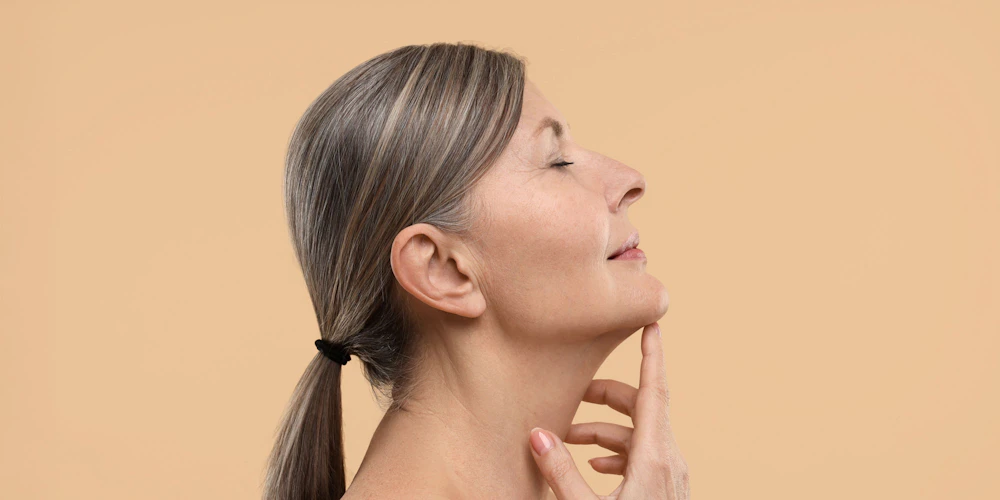 Woman with no double chin after Kybella treatment