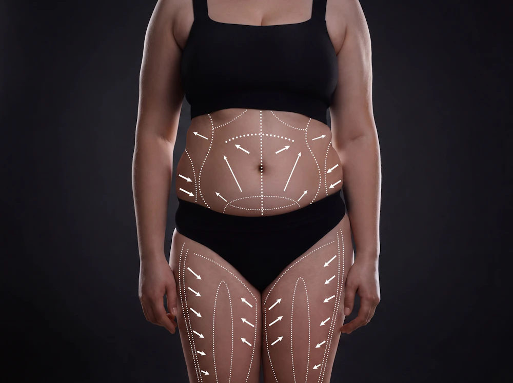 Illustration of areas that can be contoured through surgery