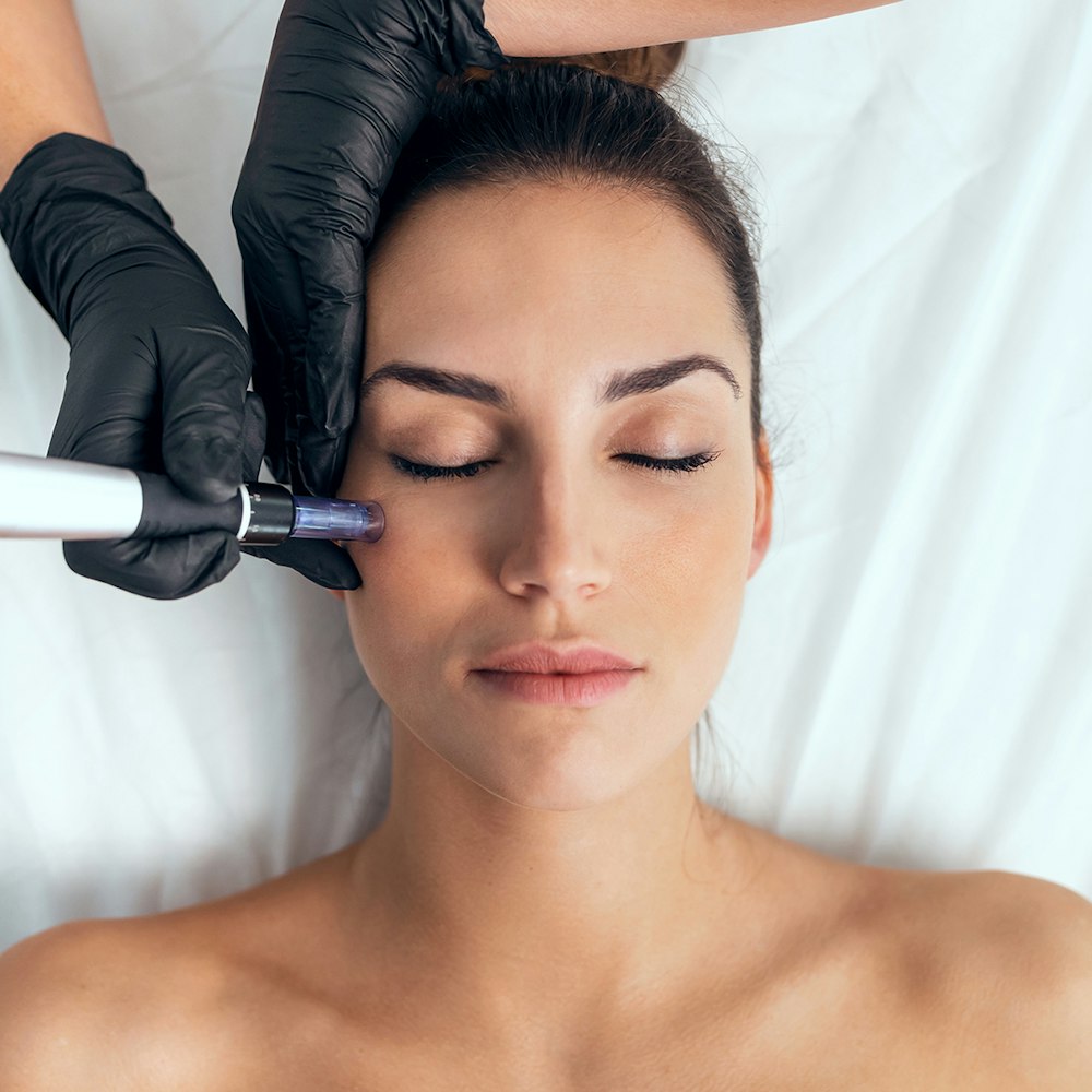 Woman receiving microneedling procedure