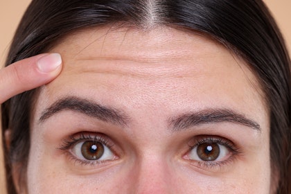 close-up of forehead wrinkles