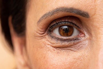 Close-up of crow's feet