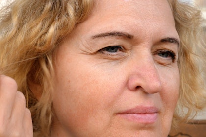 Close-up of drooping eyelids