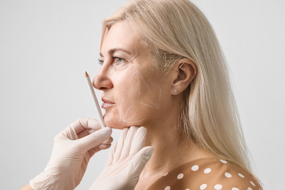 Woman's face getting marked up before treatment