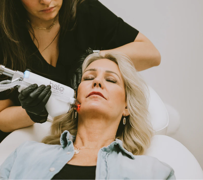 HALO Skin Resurfacing treatment