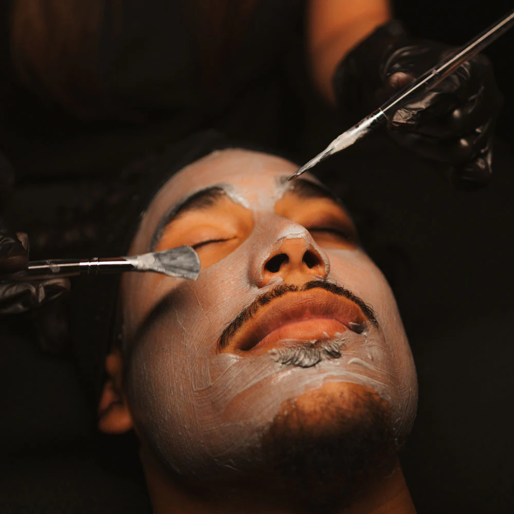 close up of real patient getting chemical peel