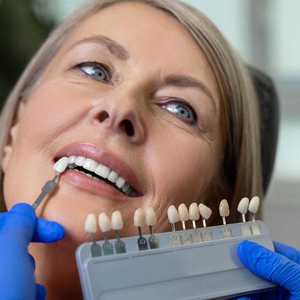 Dentist comparing different veneer shades to woman's smile
