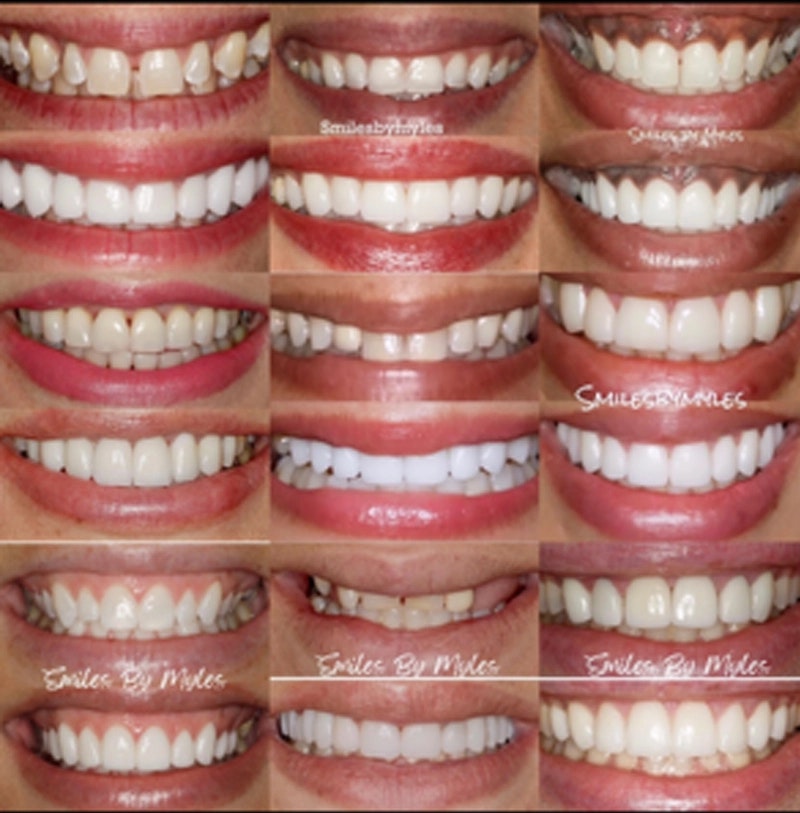 collage of 9 different Before and Afters from Wayne Myles, DDS