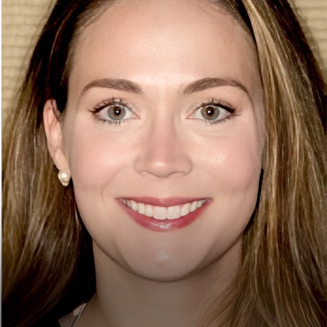 Smile makeover patient