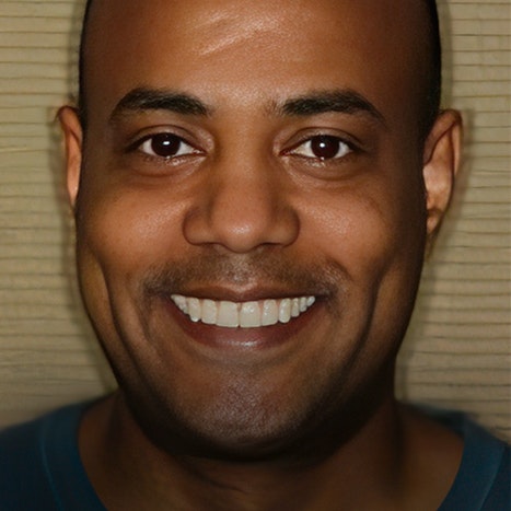 Smiles by Myles CandidPro patient