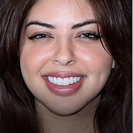 Smiles by Myles gum reshaping patient