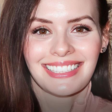 Smiles by Myles dental crown patient