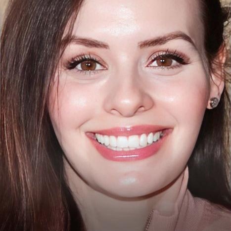 Smiles by Myles dental crown patient