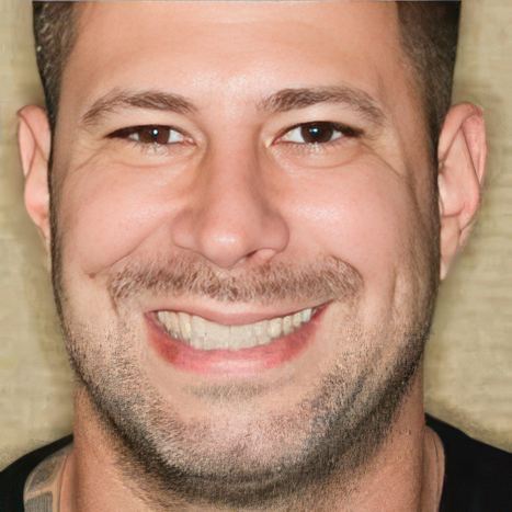 Smiles by Myles dental bonding patient