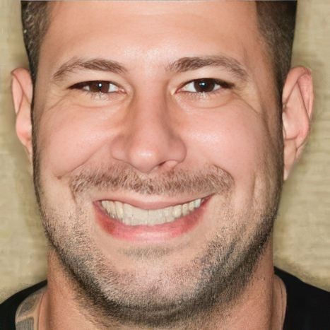 Smiles by Myles dental bonding patient