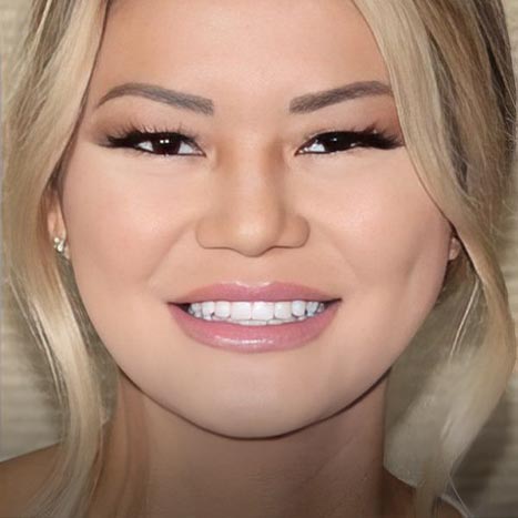 Smiles by Myles teeth whitening patient