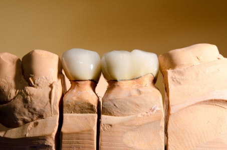 Dental model and crowns