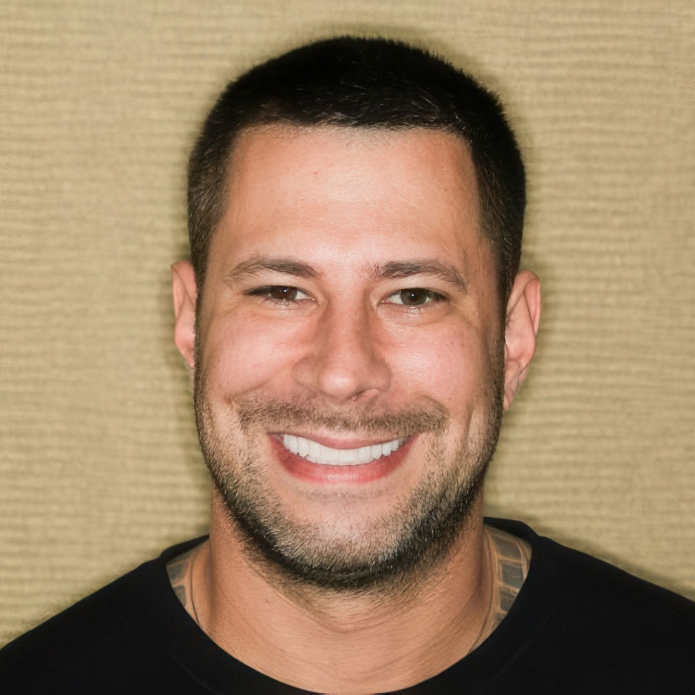 Smiles by Myles dental bonding patient