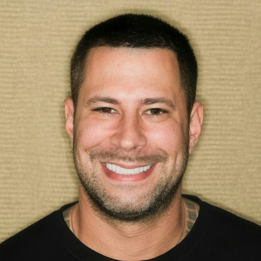 Smiles by Myles dental bonding patient