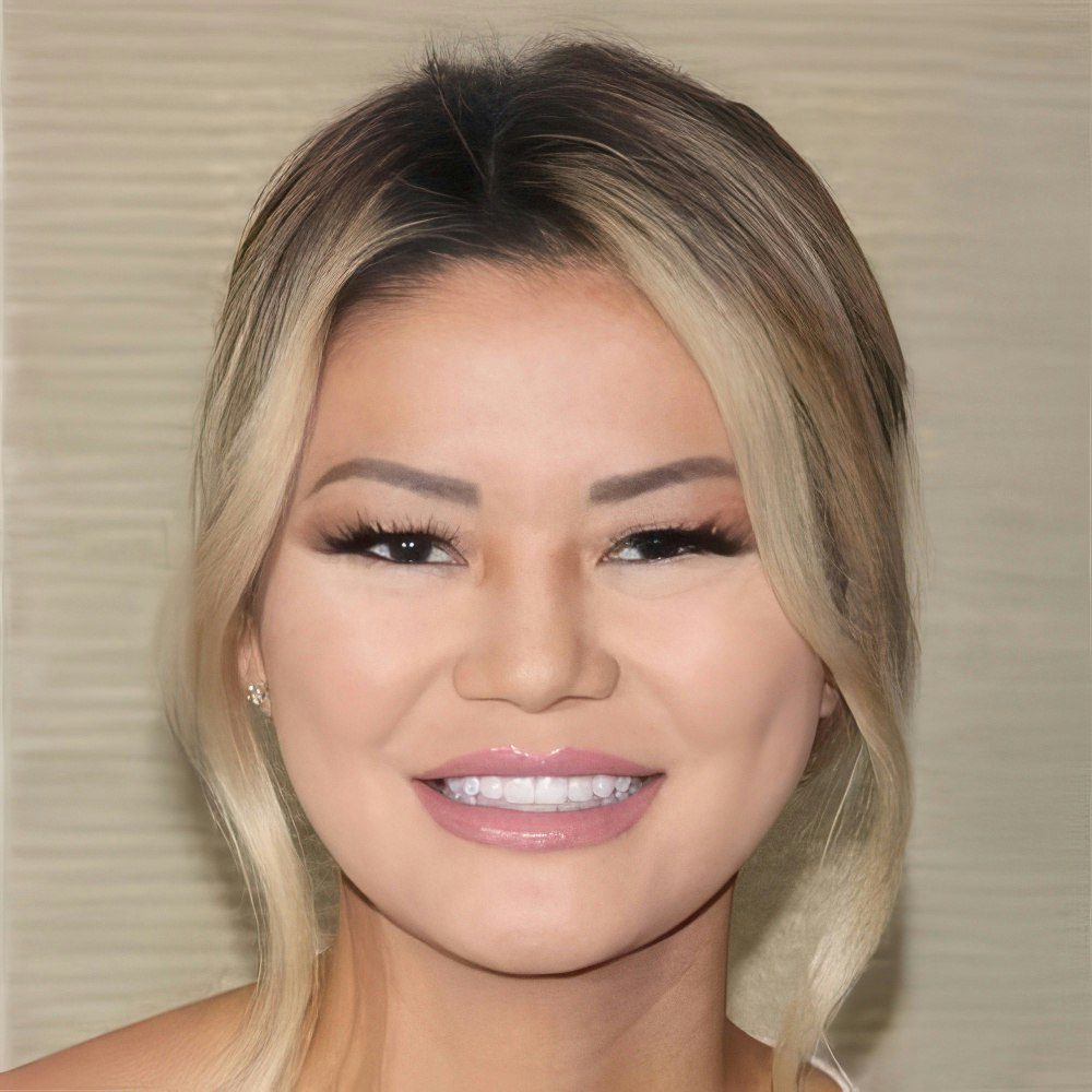Smiles by Myles teeth whitening patient