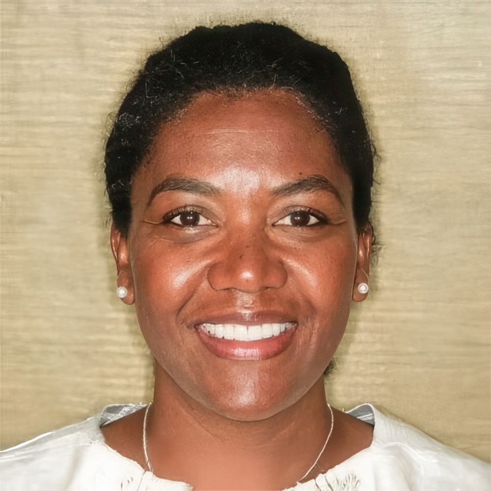 Smiles by Myles gum reshaping patient
