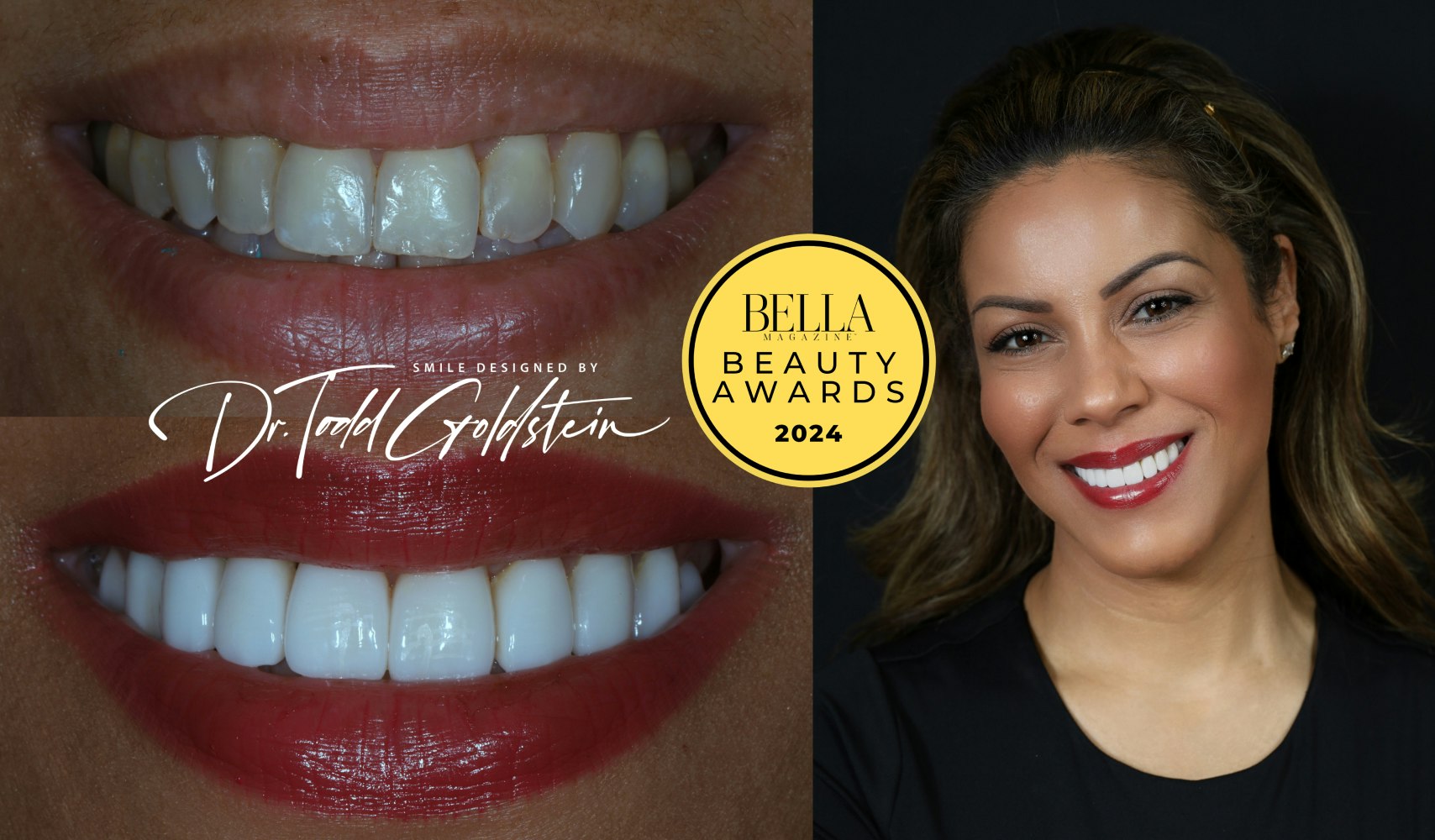 Bella Beauty Awards with before and after treatment images