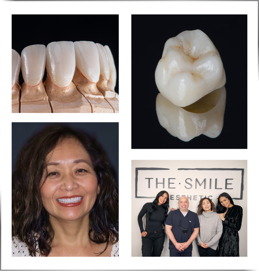 Crowns, crown patient, and dental staff