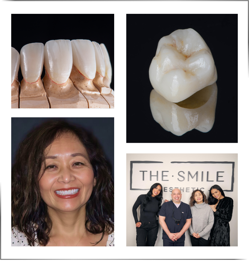 Crowns, crown patient, and dental staff
