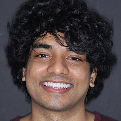 Dr. Todd Goldstein's patient Sakib after veneers