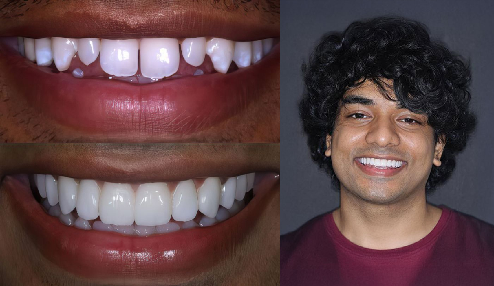 Patient before and after cosmetic treatment