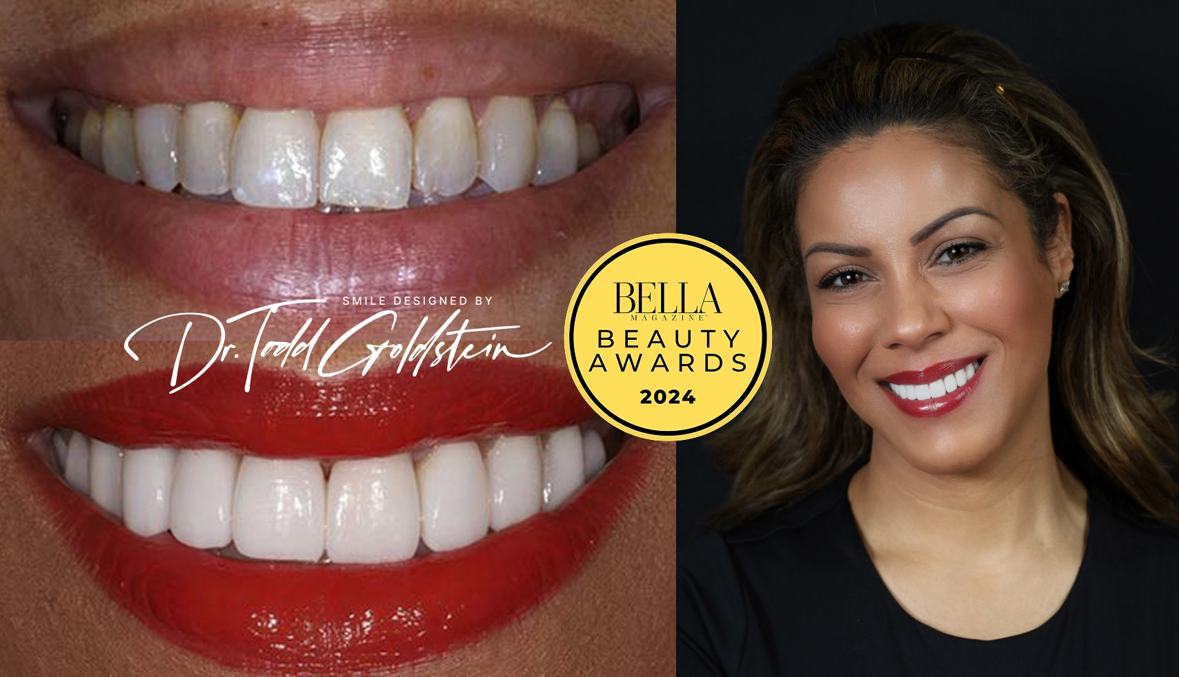 Bella Beauty Awards with before and after treatment images