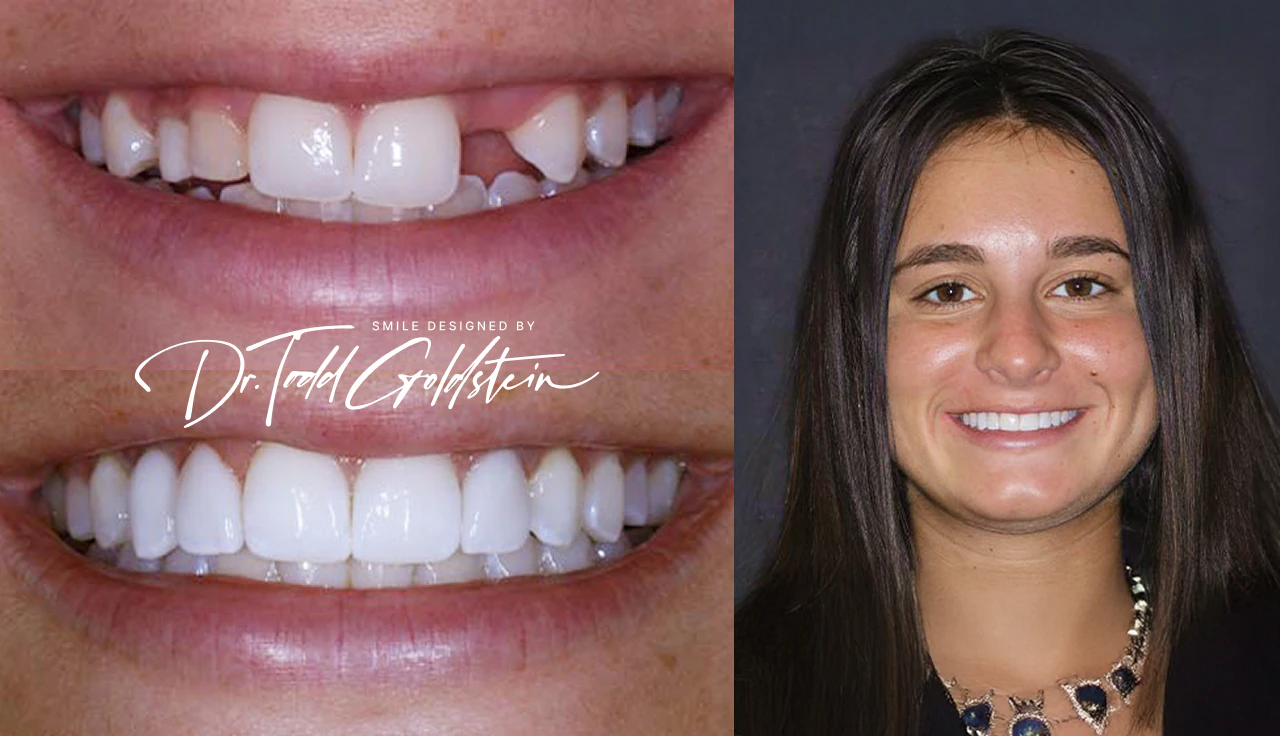 smile repair by Dr. Todd Goldstein