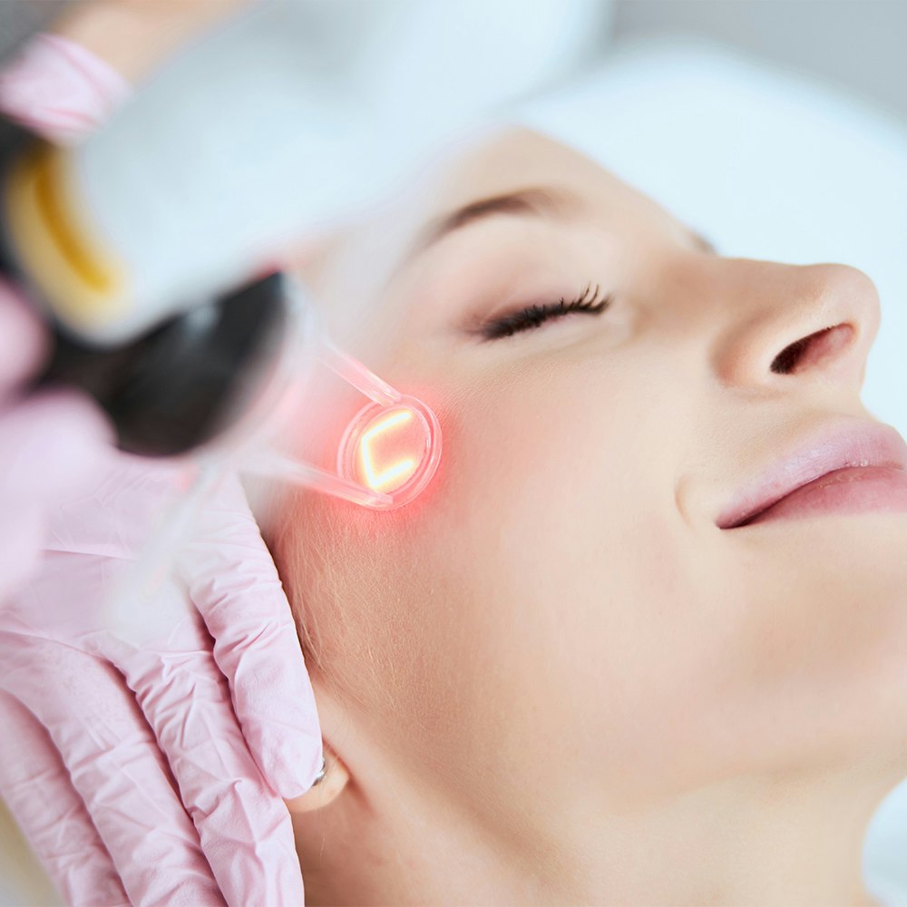 a woman getting laser resurfacing on her face