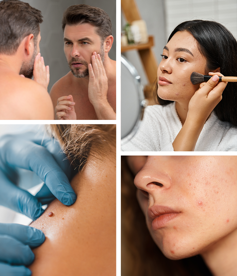 collage showing potential treatment areas for laser skin resurfacing