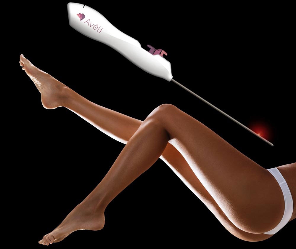 Aveli laser with woman's legs