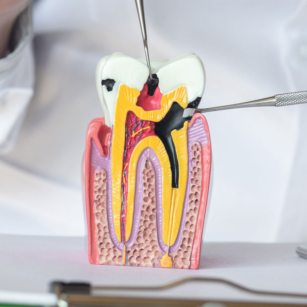 tooth model